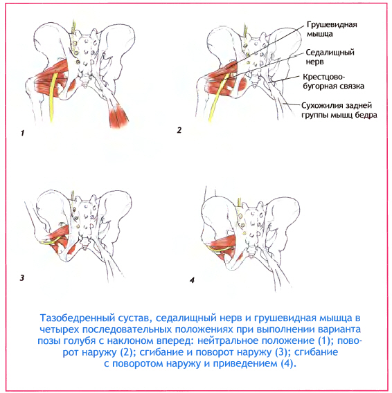 Расположение седалищного нерва и различной мышцы при различном положении тазобедренного сустава